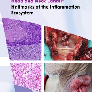 Head and Neck Cancer Hallmarks of the Inflammation Ecosystem