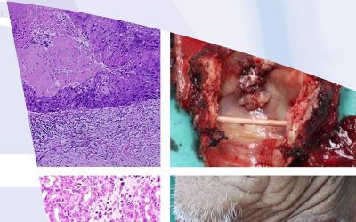 Head and Neck Cancer Hallmarks of the Inflammation Ecosystem