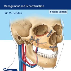 Head and Neck Cancer: Management and Reconstruction 2nd Edition