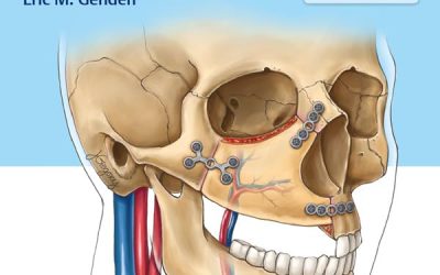 Head and Neck Cancer: Management and Reconstruction 2nd Edition