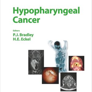 Hypopharyngeal Cancer (Advances in Oto-Rhino-Laryngology, Vol. 83)