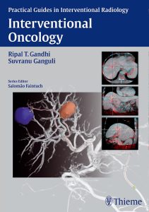 Interventional Oncology (Practical Guides in Interventional Radiology) Illustrated Edition