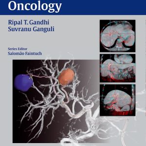 Interventional Oncology (Practical Guides in Interventional Radiology) Illustrated Edition