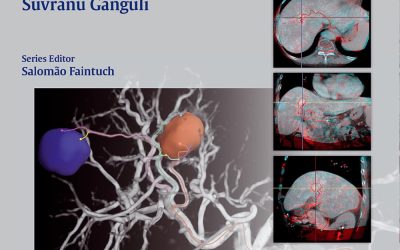 Interventional Oncology (Practical Guides in Interventional Radiology) Illustrated Edition