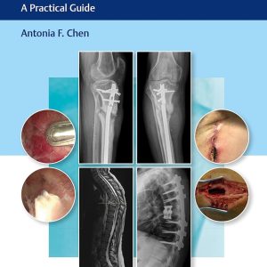 Management of Orthopaedic Infections: A Practical Guide 1st Edition