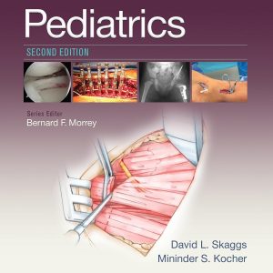 Master Techniques in Orthopaedic Surgery: Pediatrics 2nd Edition