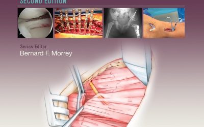 Master Techniques in Orthopaedic Surgery: Pediatrics 2nd Edition