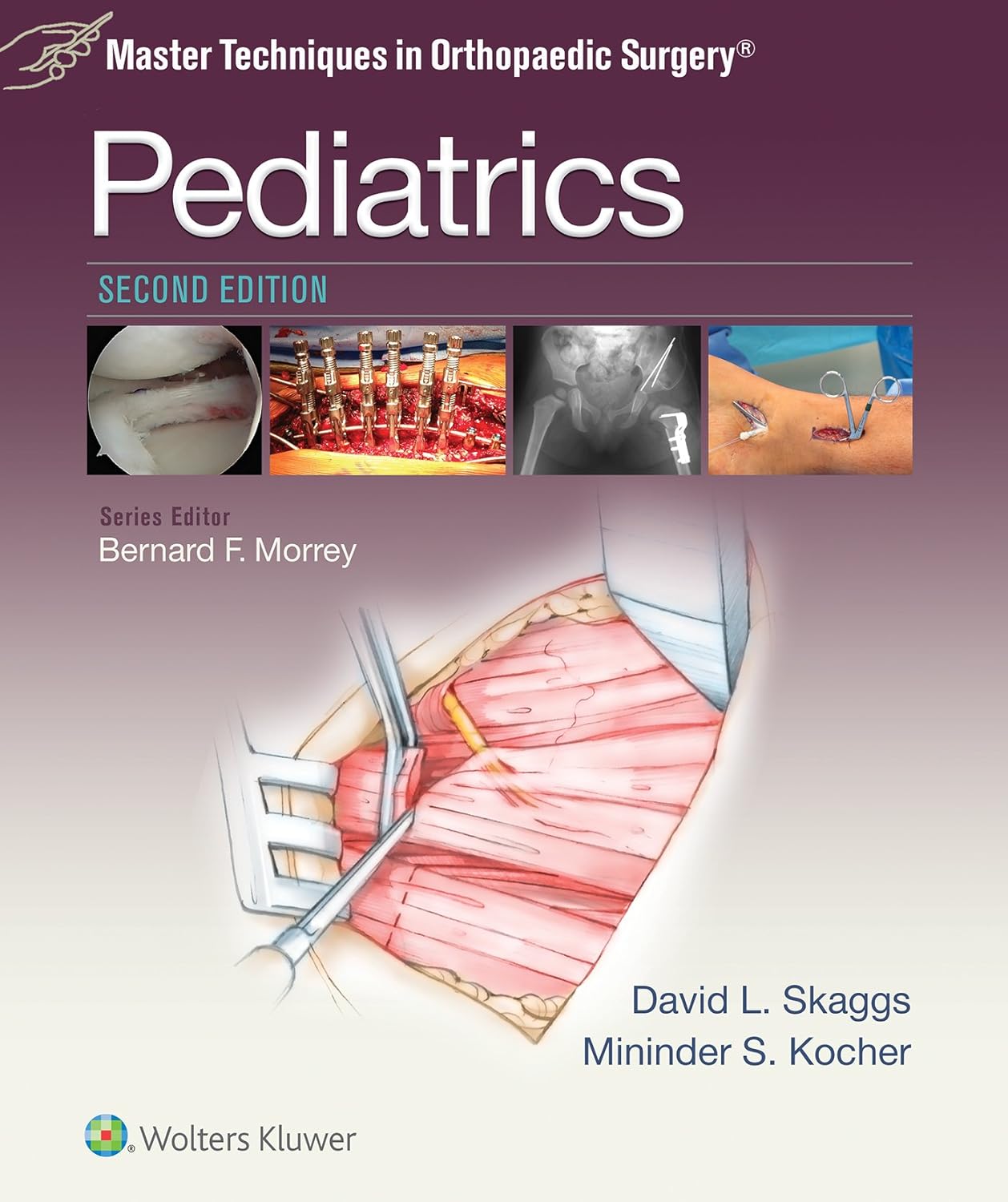 Master Techniques in Orthopaedic Surgery Pediatrics Master Techniques in Orthopaedic Surgery: Pediatrics 2nd Edition