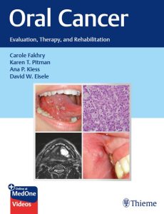 Oral Cancer: Evaluation, Therapy, and Rehabilitation 1st Edition