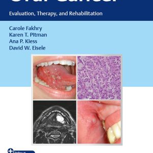 Oral Cancer: Evaluation, Therapy, and Rehabilitation 1st Edition
