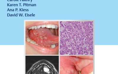 Oral Cancer: Evaluation, Therapy, and Rehabilitation 1st Edition