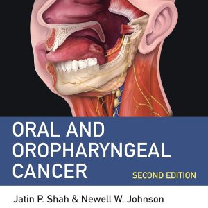 Oral and Oropharyngeal Cancer 2nd Edition