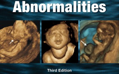 Sanders’ Structural Fetal Abnormalities, Third Ed 3rd Edition