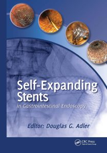 Self-Expanding Stents in Gastrointestinal Endoscopy 1st Edition