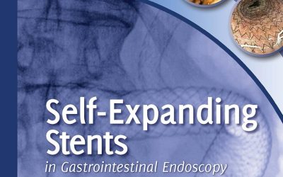 Self-Expanding Stents in Gastrointestinal Endoscopy 1st Edition