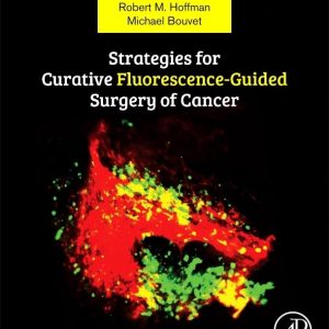 Strategies for Curative Fluorescence-Guided Surgery of Cancer 1st Edition