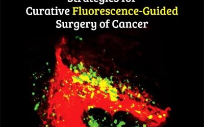 Strategies for Curative Fluorescence-Guided Surgery of Cancer 1st Edition