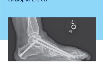 Synopsis of Foot and Ankle Surgery 1st Edition