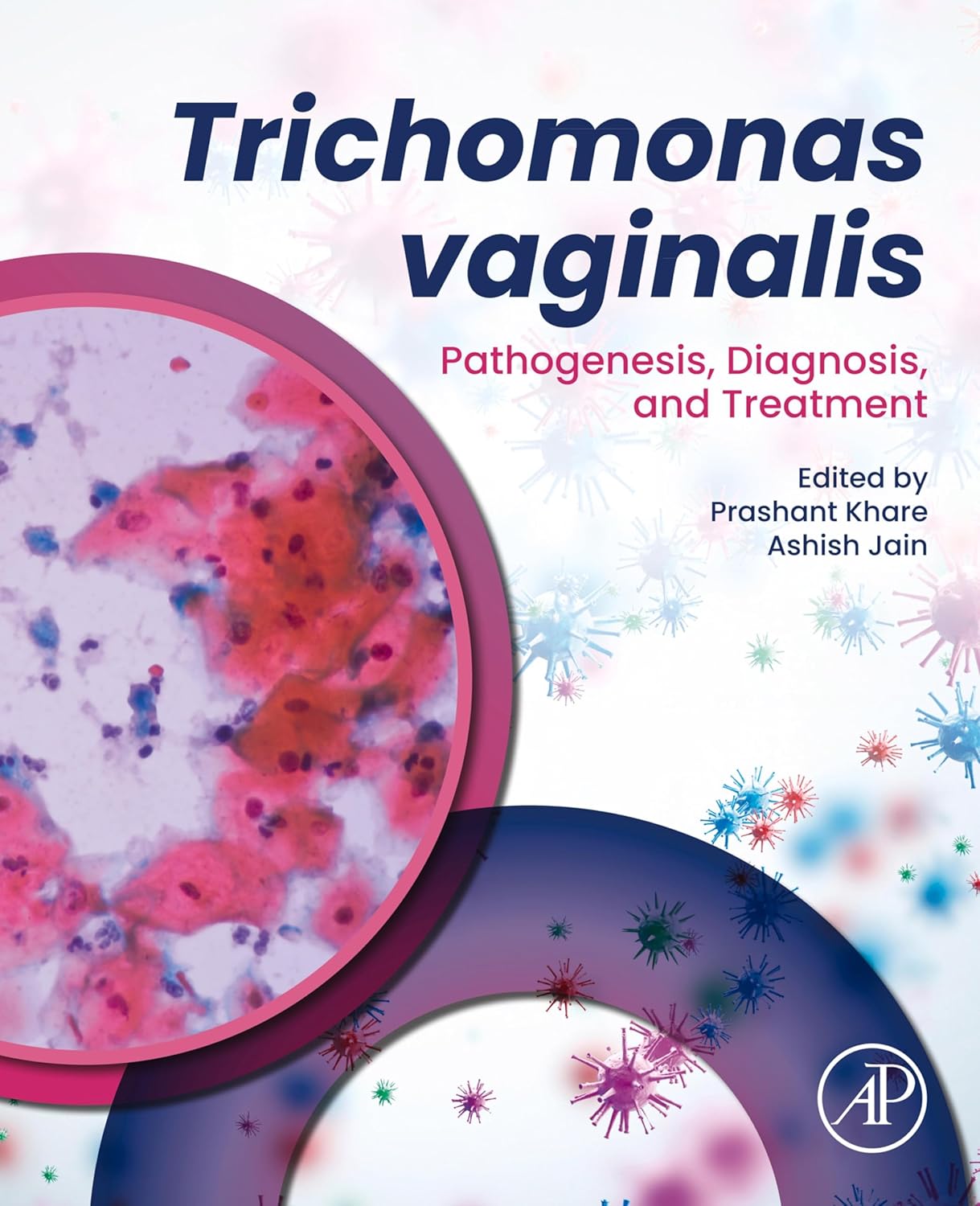 Trichomonas Vaginalis Pathogenesis, Diagnosis, and Treatment