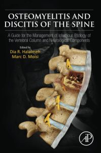 Osteomyelitis and Discitis of the Spine: A Guide for the Management of Infectious Etiology of the Vertebral Column and Neurological Components First Edition
