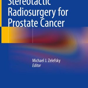 Stereotactic Radiosurgery for Prostate Cancer First Edition