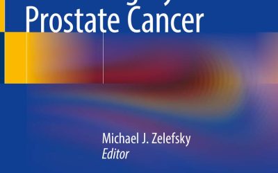 Stereotactic Radiosurgery for Prostate Cancer First Edition