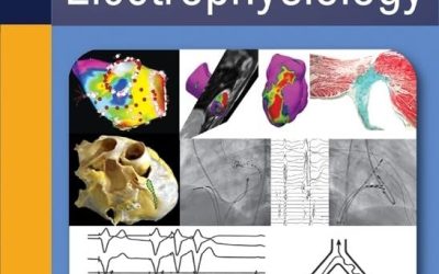 Practical Cardiac Electrophysiology First Edition
