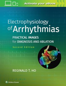Electrophysiology of Arrhythmias: Practical Images for Diagnosis and Ablation Second Edition
