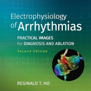 Electrophysiology of Arrhythmias: Practical Images for Diagnosis and Ablation Second Edition