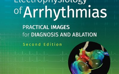 Electrophysiology of Arrhythmias: Practical Images for Diagnosis and Ablation Second Edition