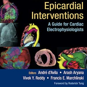 Percutaneous Epicardial Interventions: A Guide for Cardiac Electrophysiologists First Edition