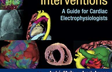 Percutaneous Epicardial Interventions: A Guide for Cardiac Electrophysiologists First Edition
