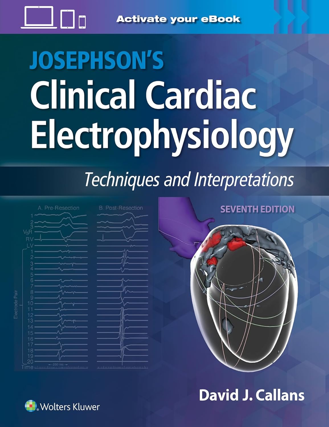 WhatsApp Image 2025-04-26 at 22.37.12 Josephson’s Clinical Cardiac Electrophysiology: Techniques and Interpretations