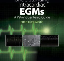 Understanding Intracardiac EGMs: A Patient Centered Guide First Edition