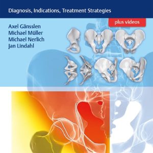 Acetabular Fractures: Diagnosis, Indications, Treatment Strategies First Edition