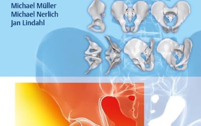 Acetabular Fractures: Diagnosis, Indications, Treatment Strategies First Edition