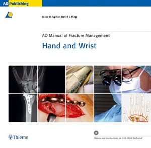 Ao Manual of Fracture Management: Hand & Wrist