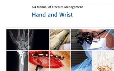 Ao Manual of Fracture Management: Hand & Wrist
