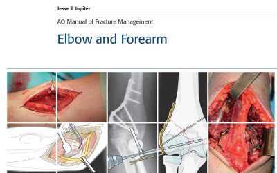 AO Manual of Fracture Management – Elbow and Forearm