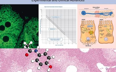 Acetaminophen Toxicity: Experimental and Clinical Advances First Edition