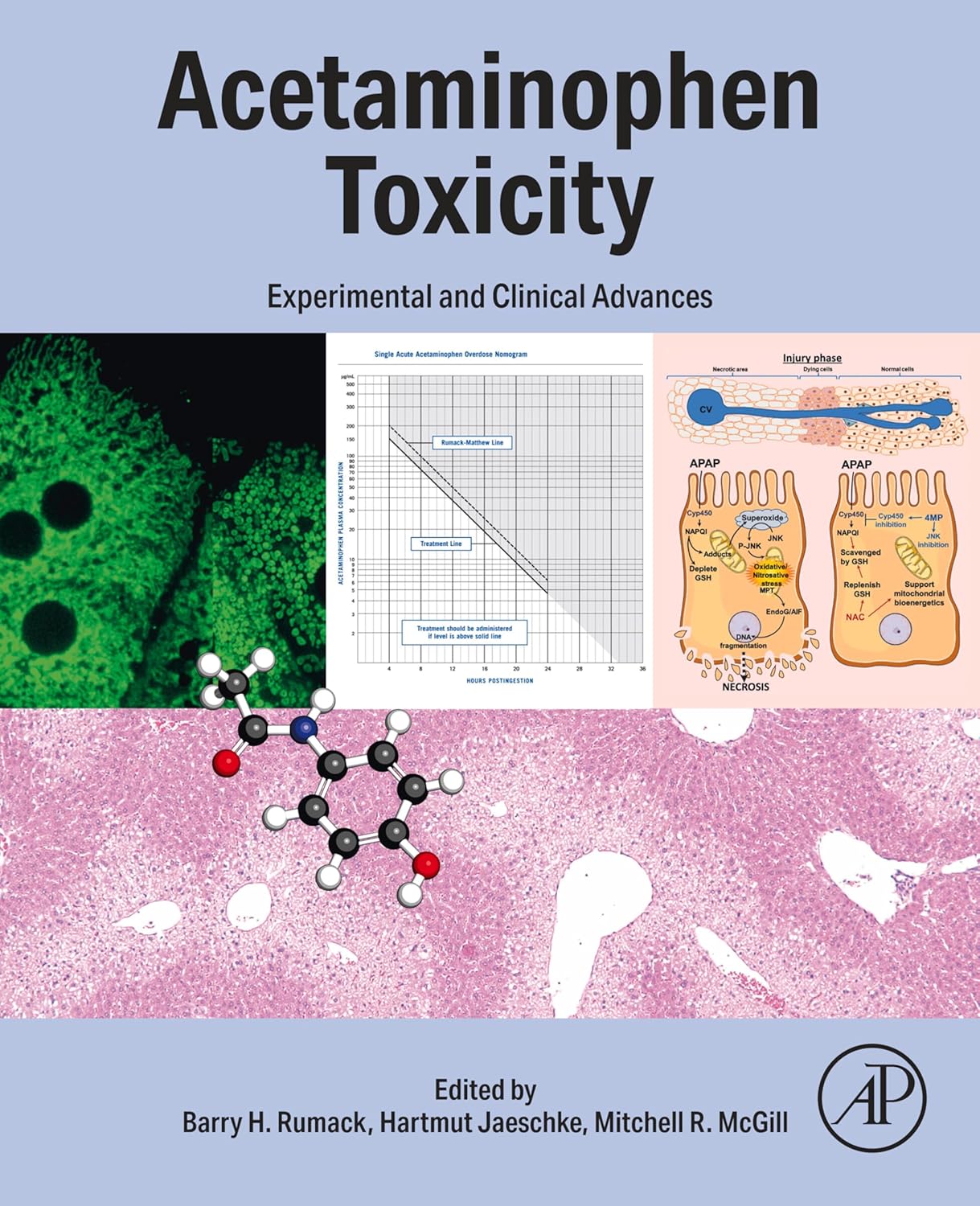 WhatsApp Image 2025-04-29 at 20.40.23 Acetaminophen Toxicity: Experimental and Clinical Advances First Edition