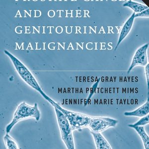 Handbook of Prostate Cancer and Other Genitourinary Malignancies First Edition