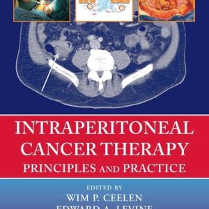Intraperitoneal Cancer Therapy: Principles and Practice First Edition