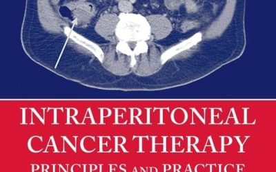 Intraperitoneal Cancer Therapy: Principles and Practice First Edition