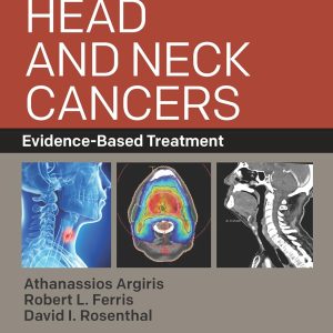 Head and Neck Cancers: Evidence-Based Treatment
