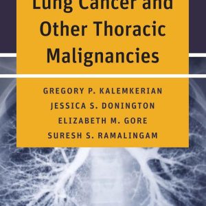 Handbook of Lung Cancer and Other Thoracic Malignancies First Edition
