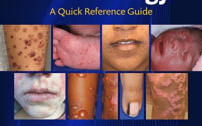 Pediatric Dermatology: A Quick Reference Guide Fifth Edition