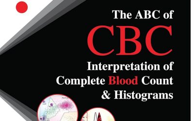 The ABC of CBC: Interpretation Second Edition of Complete Blood Count & Histograms