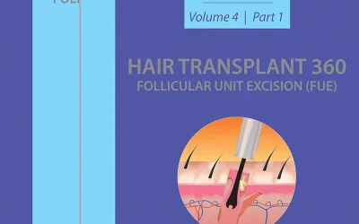 Hair Transplant 360: Follicular Unit Excision (FUE) Vol. 4 (Part 1 & 2): Volume