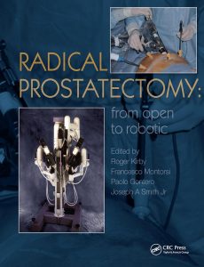 Radical Prostatectomy: From Open to Robotic 1st Edition